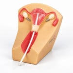 IUD Training Model
